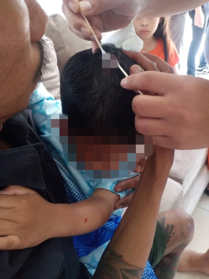 กระจกคาเฟ่แตกใส่เด็ก