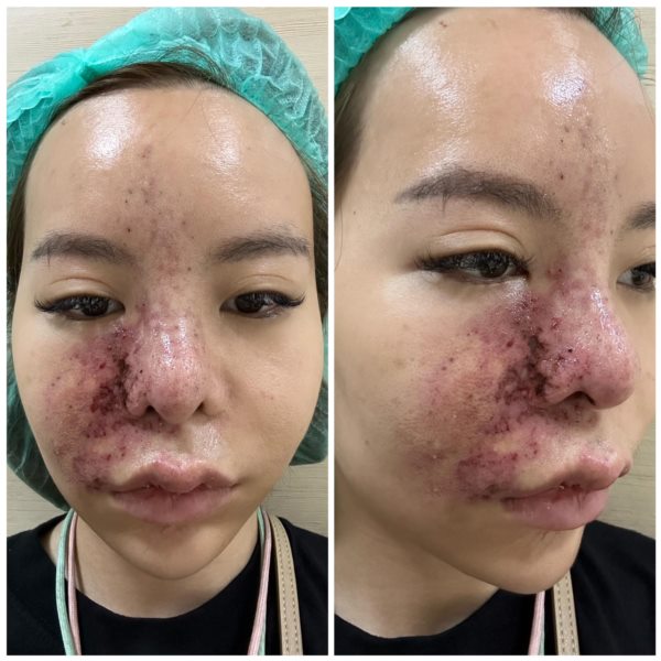 น้องมะลิ