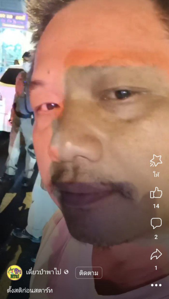 ยูทูบเบอร์เจอคนเมายิง