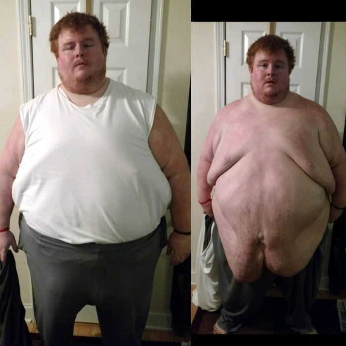 พลิกชีวิต จากอดีตอ้วน 383 กก. 