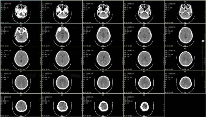พยายามฆ่า