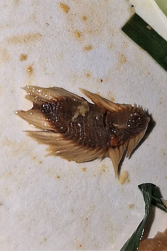 สิ่งแปลกปลอมในอาหาร