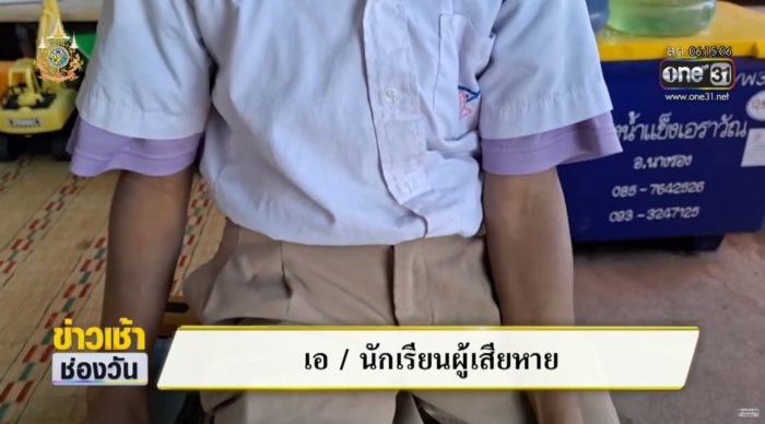  เด็ก 9 ขวบอนาจารสุนัข