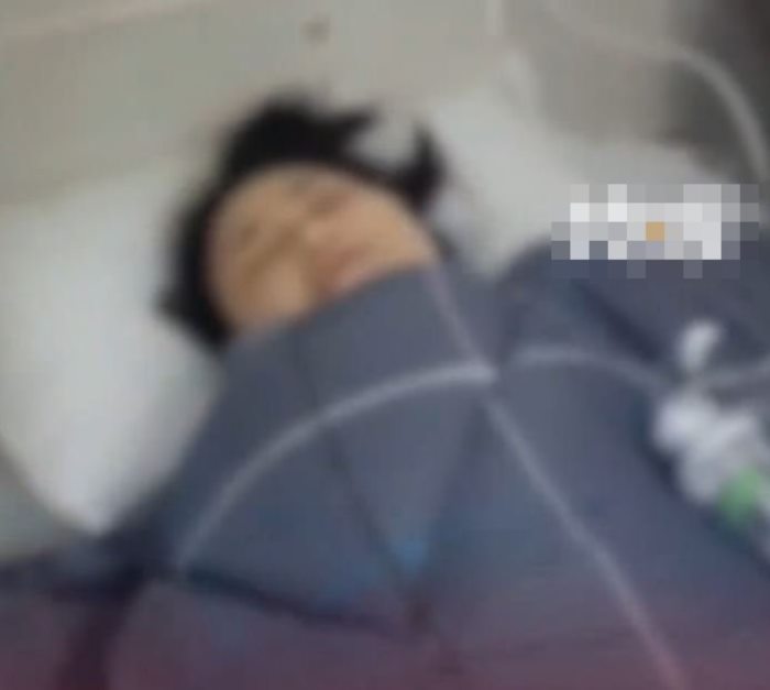 กระดูกหัก