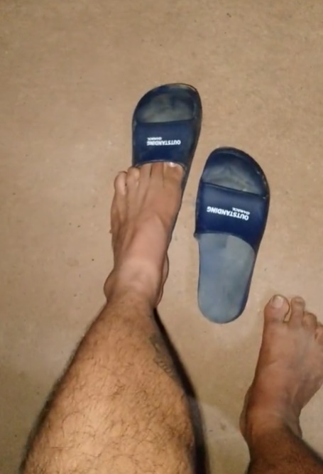 แดดเผาจนรองเท้าหด