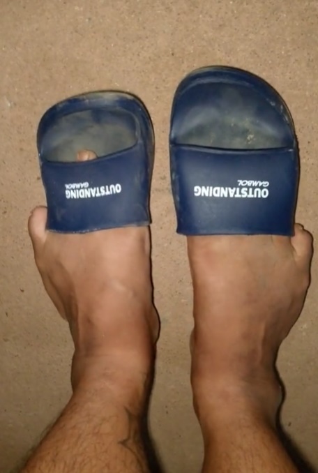 แดดเผาจนรองเท้าหด