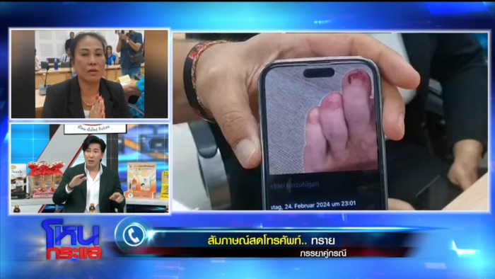 ฝรั่งทำร้ายหมอ