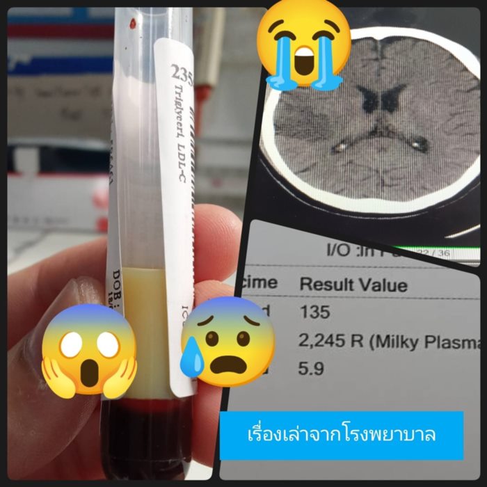 ค่าไตร์กลีเซอร์ไรด์พุ่ง 