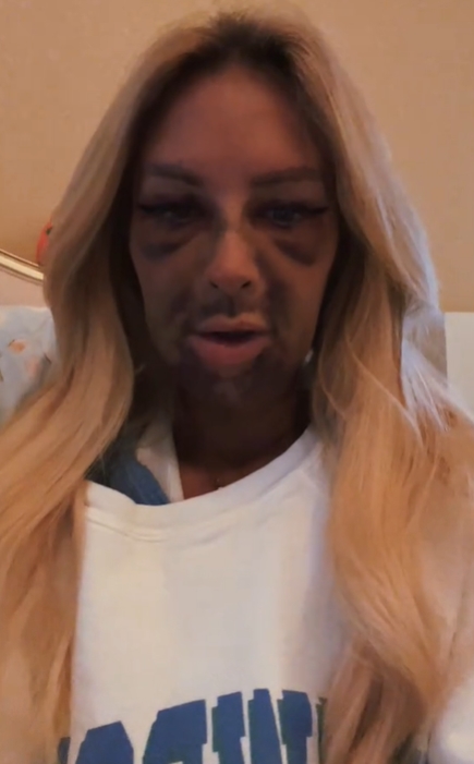  รากฟันเทียม