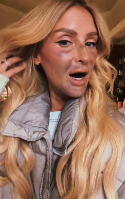  รากฟันเทียม