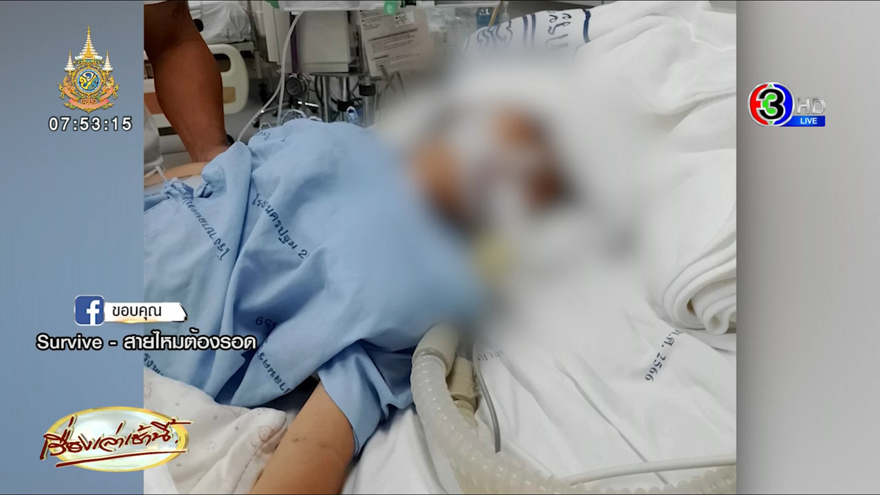 ไข้หวัดใหญ่