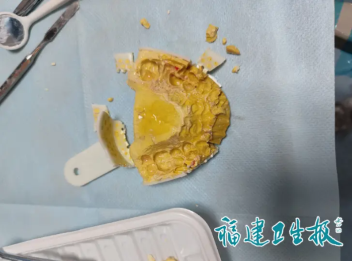 พิมพ์ฟันที่บ้าน