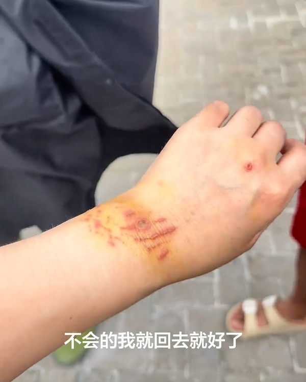 สาวดำน้ำดูฉลาม ไม่หวั่นแม้มี ปจด. ช็อกถูกฉลามกัด