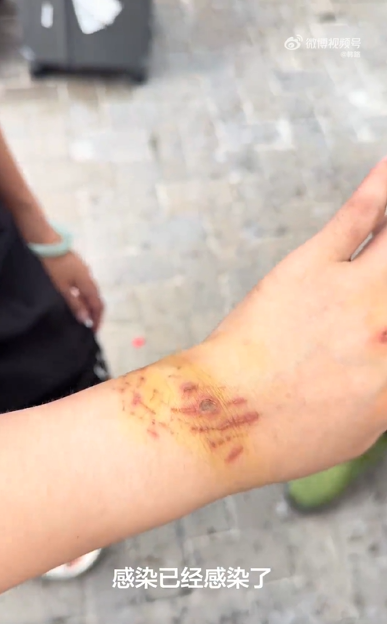 สาวดำน้ำดูฉลาม ไม่หวั่นแม้มี ปจด. ช็อกถูกฉลามกัด