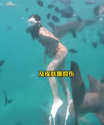 สาวดำน้ำดูฉลาม ไม่หวั่นแม้มี ปจด. ช็อกถูกฉลามกัด