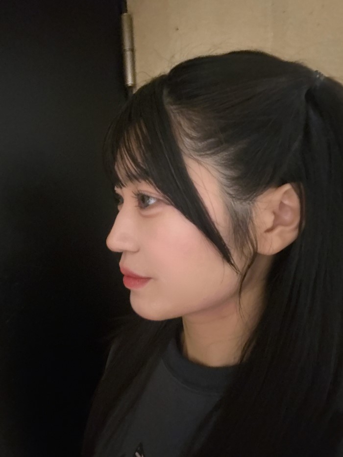 ไอดอลญี่ปุ่นวัย 22 ปี เผยภาพเปรียบเทียบก่อน–หลัง 