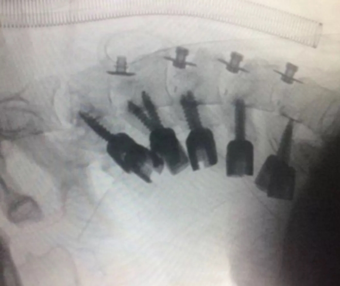  โรคศีรษะห้อย !