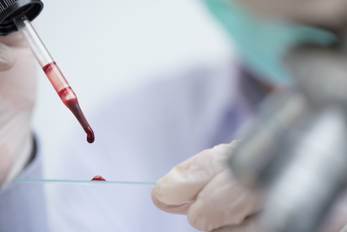 เลือดหนืด