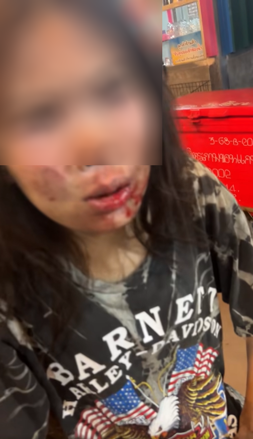 ทำร้ายร่างกาย