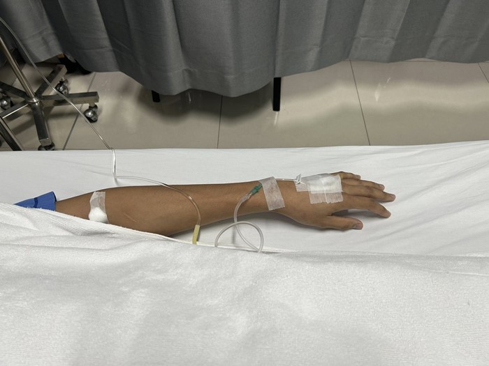 ไข้รากสาด