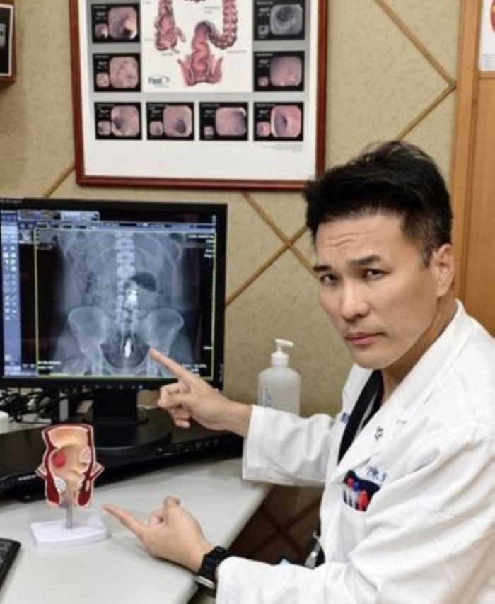 ลำไส้ทะลุ