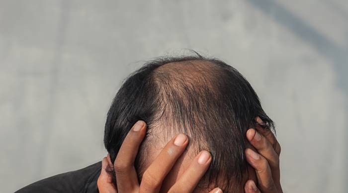 กินไข่วันละ 3 ฟอง ทำไมผมบาง