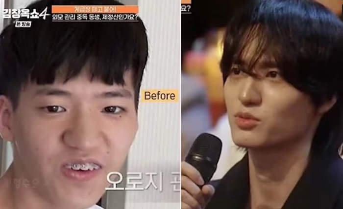  ปฏิเสธศัลยกรรม แต่ได้หน้าแบบไอดอล   