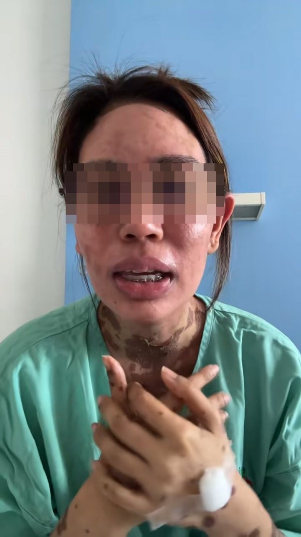  ผื่นขึ้น อย่ามองข้าม 