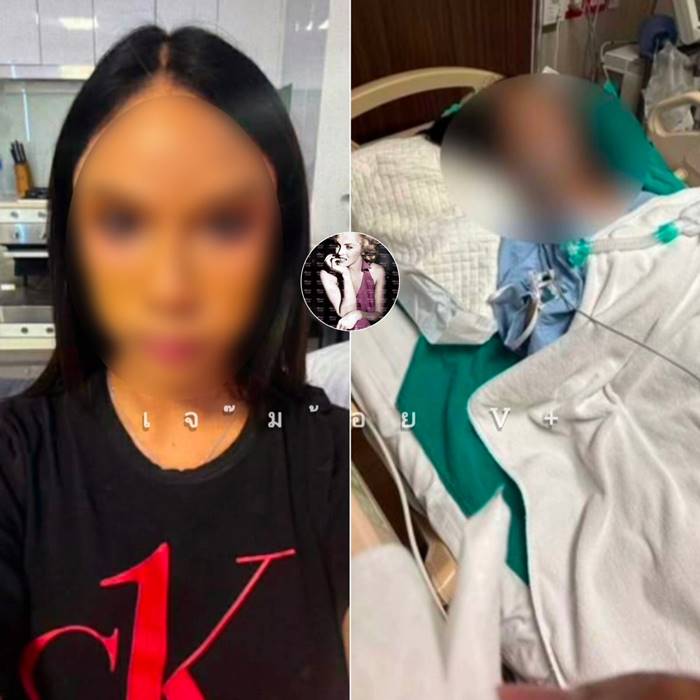 อินฟลูฯ ดับหลังแก้จมูก 