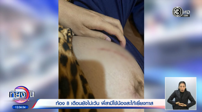 ทำร้ายร่างกาย