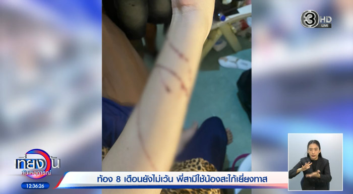 ทำร้ายร่างกาย