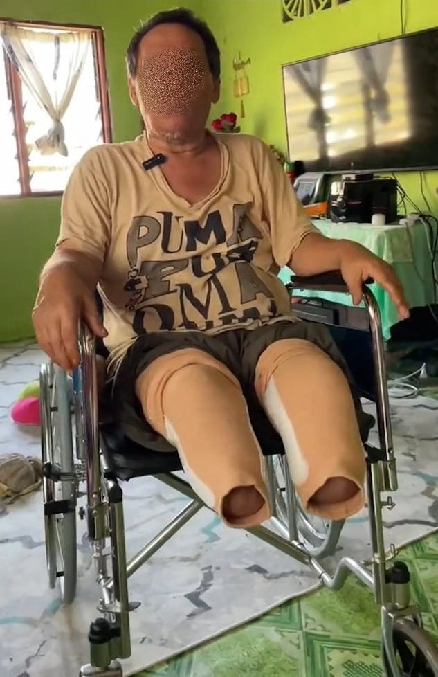 อร่อยจนต้องตัดขา 2 ข้าง 