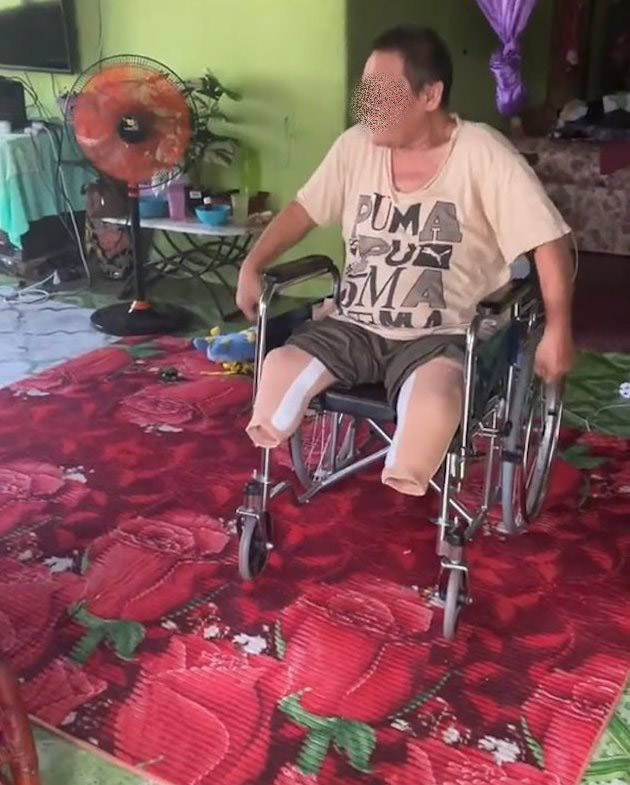 อร่อยจนต้องตัดขา 2 ข้าง 