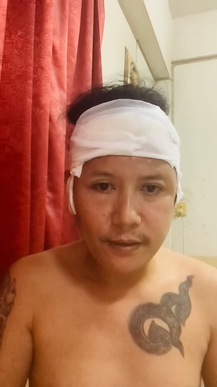  เตือนระวัง ยาย้อมผม ทำพิษ