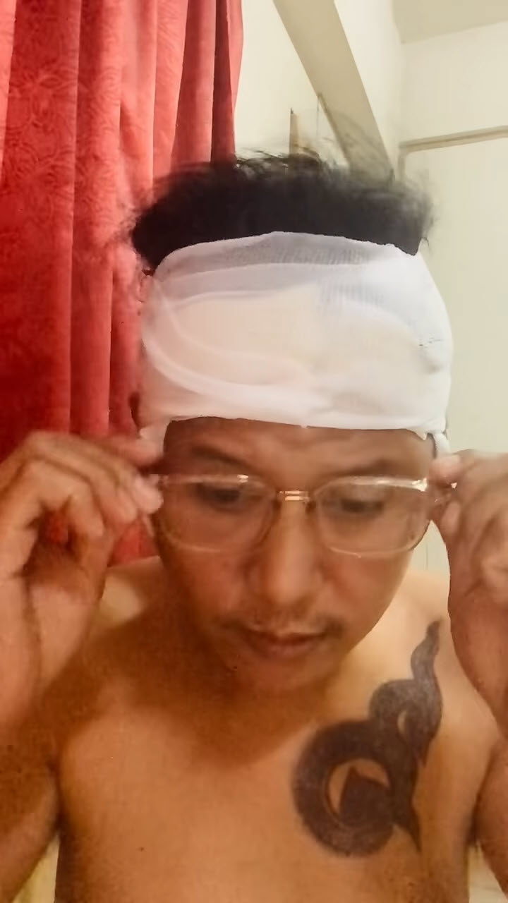  เตือนระวัง ยาย้อมผม ทำพิษ