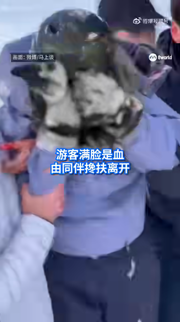 สาวเห็นเสือดาวหิมะโผล่