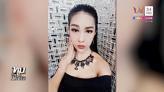 ศัลยกรรมหน้าพัง