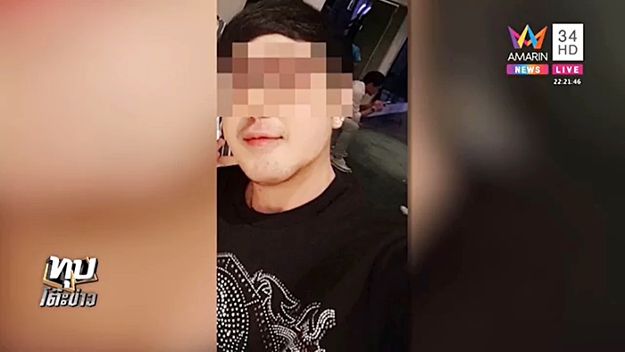 ศัลยกรรมหน้าพัง