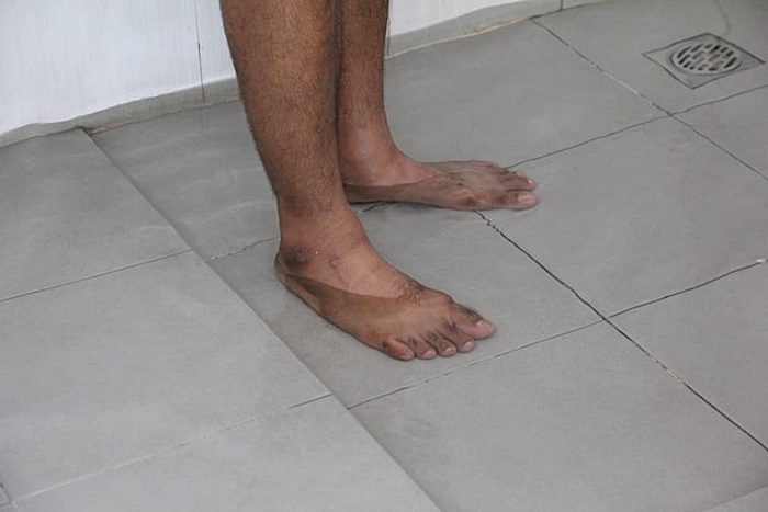  บ้านจัดสรร