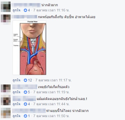 หมอนวดกดเส้น