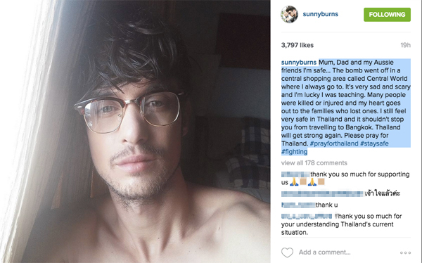 ซันนี่ เบิร์น