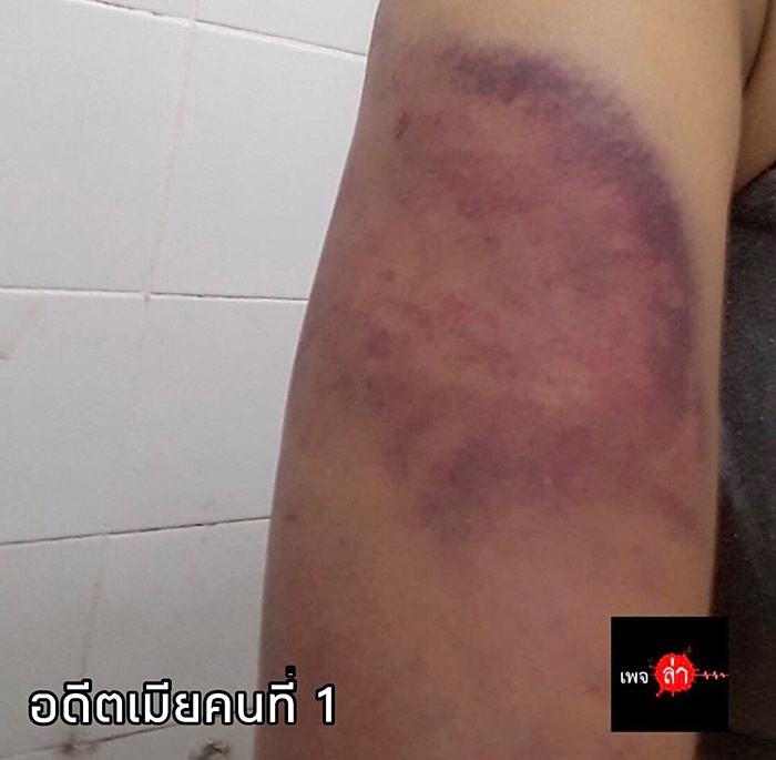 ผัวซ้อมเมีย