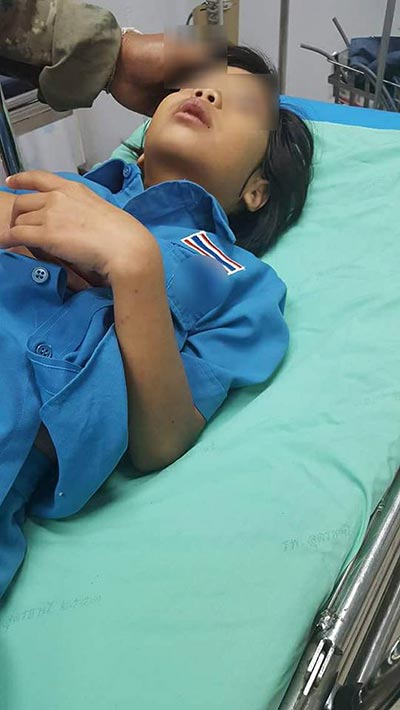 ทำร้ายร่างกาย