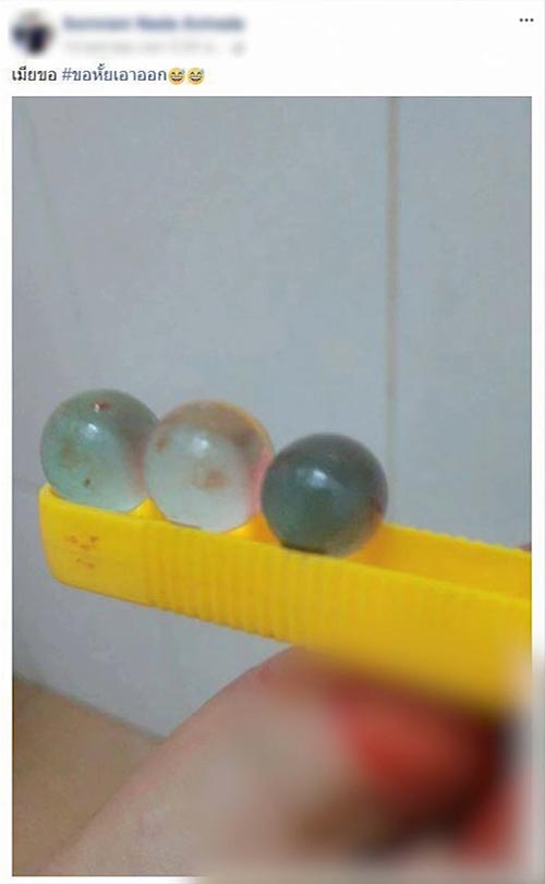 กรีดอวัยวะเพศ