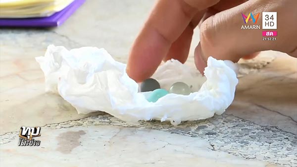 กรีดอวัยวะเพศ