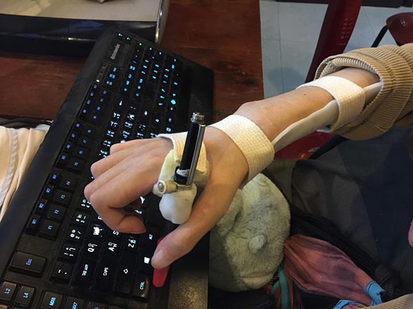 หนุ่มพิการ