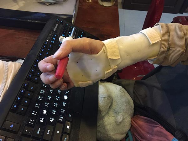 หนุ่มพิการ