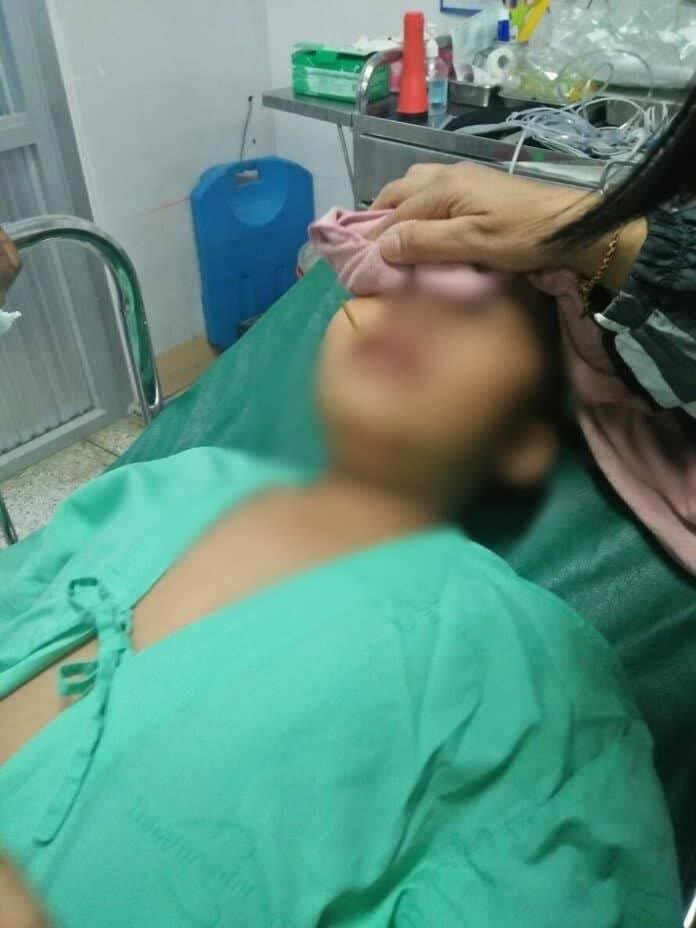 มอเตอร์ไซค์ชนกัน