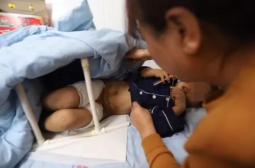 แม่เลี้ยงทำร้ายลูก