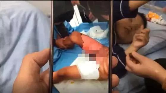 แม่เลี้ยงทำร้ายลูก